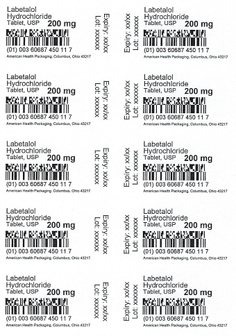 LABETALOL HYDROCHLORIDE tablet, film coated